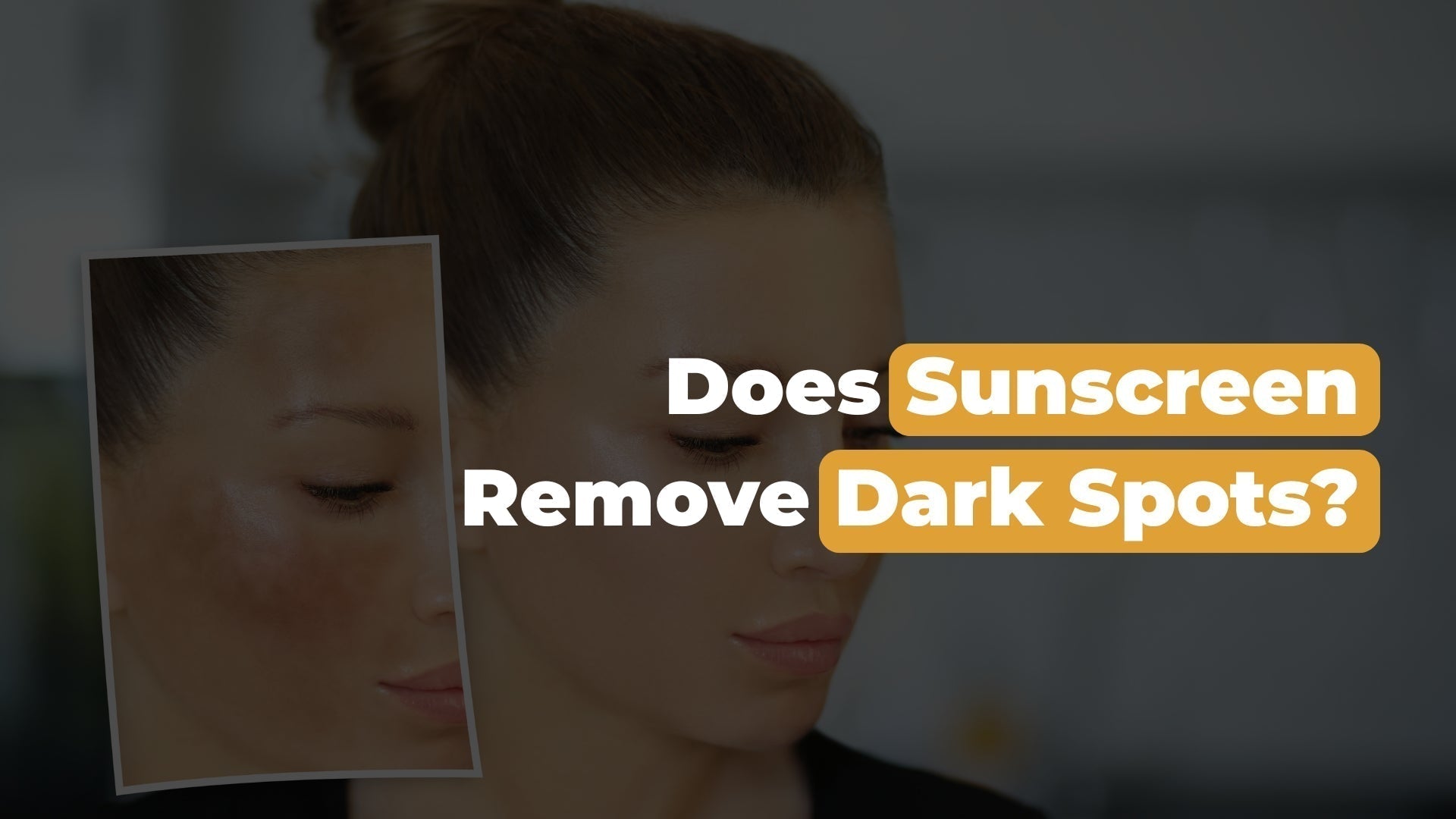 Can Sunscreen Help Fade Dark Spots?